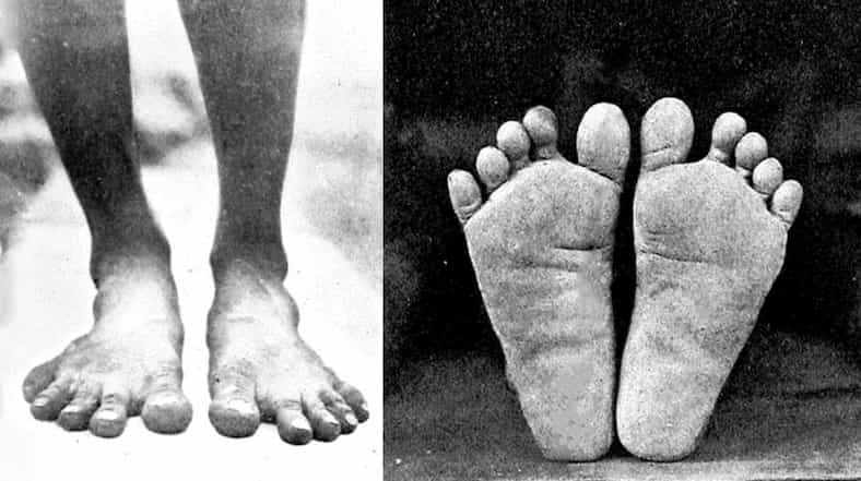 Foot Anatomy 101 1